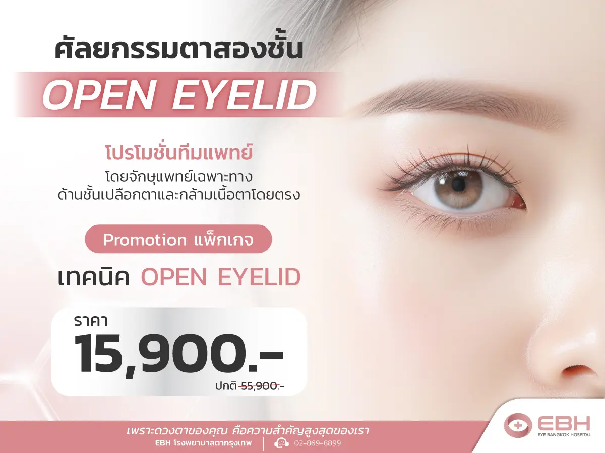  ศัลยกรรมตาสองชั้น